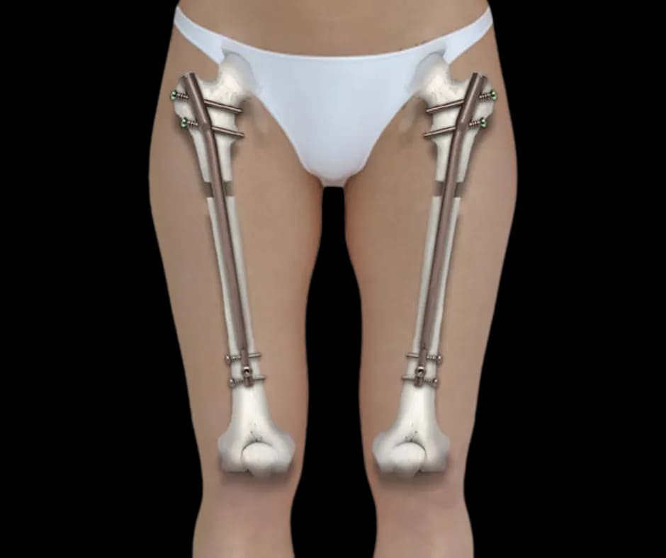 Cosmetic Center for Legs Lengthening & Legs Shape Correction — clinic photo — photo 6