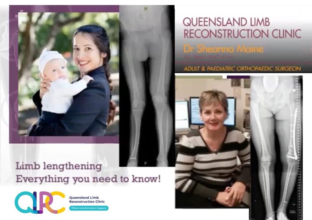 Queensland Limb Reconstruction Centre — clinic photo — photo 6