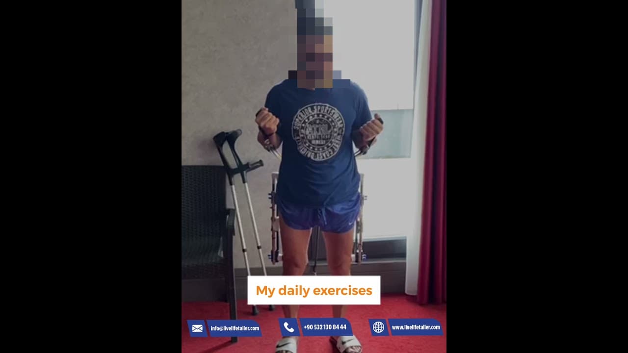 My Limb lengthening dairy with LiveLifeTaller by Dr. Halil Buldu - YouTube